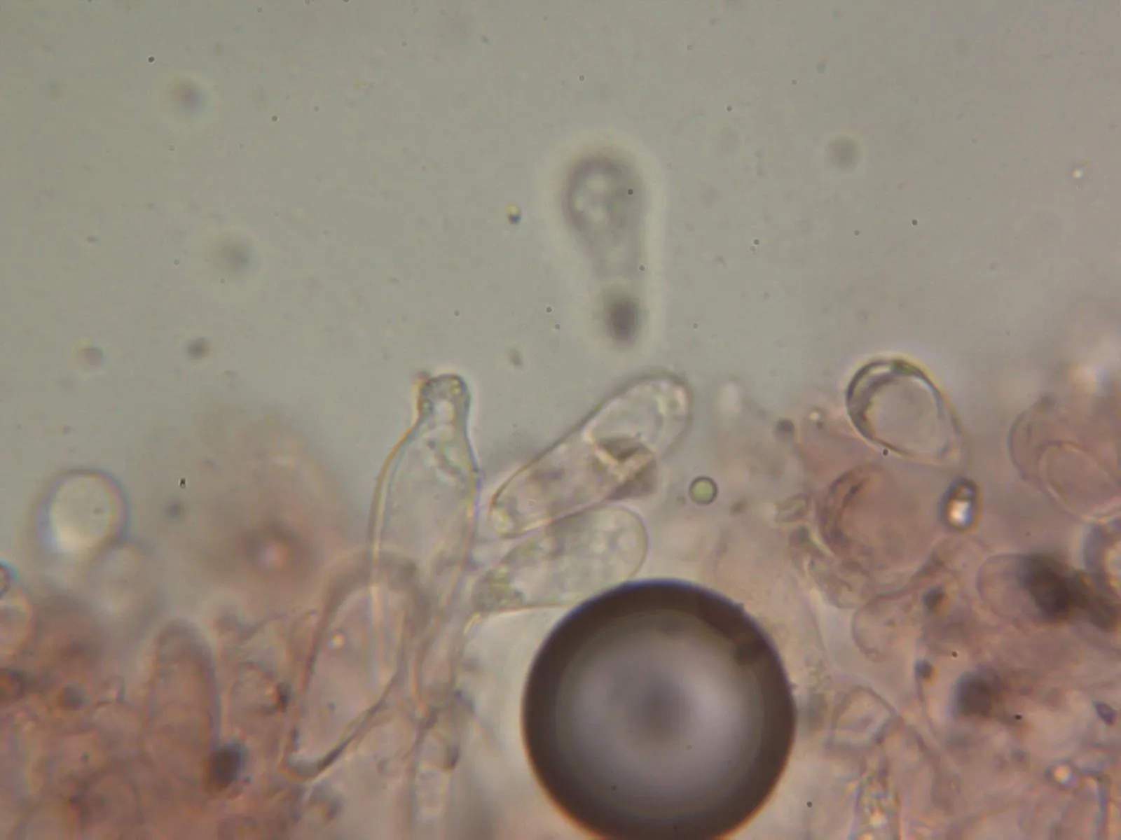 Microscopía de Leucoagaricus crystalliferoides - 10 - Queilocistidios 1